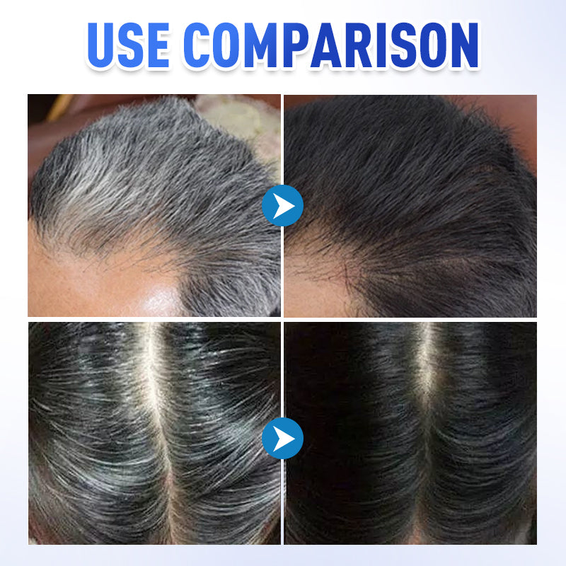 📢Hot Sale 50% OFF🔥Gentle Instant Gray Hair Cover Dye