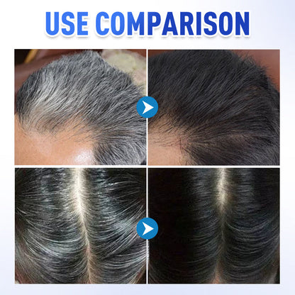 📢Hot Sale 50% OFF🔥Gentle Instant Gray Hair Cover Dye