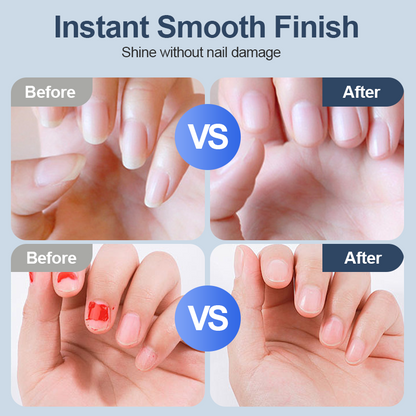 🔥Hot Sale Deals-Universal Automatic Fingernail Grinder for Adults and Children